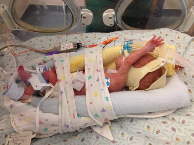 Caden as an infant in the NICU